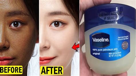 Vaseline is made up of 100 petroleum jelly which creates a good barrier which locks in moisture and protects your skin. . Does petroleum jelly lighten skin